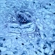 Nematode Granuloma